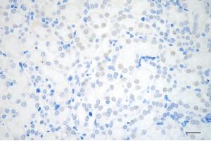 Immunohistochemistry was performed on paraffin-embedded mouse kidney using chromodomain helicase DNA binding protein 3 antibody (ABIN7798069), 1:200). (Recombinant CHD3 anticorps)