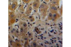 #VALUE! (NAMPT anticorps  (AA 1-491))