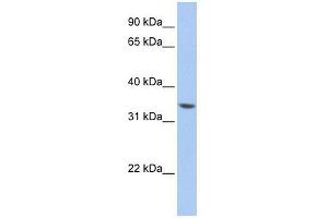 ZNF584 antibody used at 0. (ZNF584 anticorps  (Middle Region))