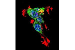 Confocal immunofluorescent analysis of CTNNB1 Antibody (N-term) with 293 cell followed by Alexa Fluor 488-conjugated goat anti-rabbit lgG (green).