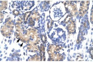 Human kidney; PSMC3 antibody - middle region in Human kidney cells using Immunohistochemistry (PSMC3 anticorps  (Middle Region))