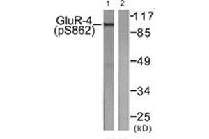 Western blot analysis of extracts from HepG2 cells treated with Forskolin 40nM 30', using GluR4 (Phospho-Ser862) Antibody. (GRIA4 anticorps  (pSer862))