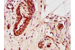 anti-Zinc Finger Protein 73 (ZNF73) (AA 218-286) antibody