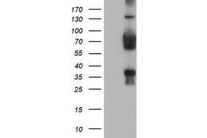 Western Blotting (WB) image for anti-Transducin-Like Enhancer Protein 2 (TLE2) antibody (ABIN1501408) (TLE2 anticorps)
