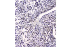 IHC analysis of HSPA2 using anti-HSPA2 antibody (ABIN5692870). (HSPA2 anticorps  (C-Term))