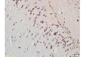 Formalin-fixed and paraffin embedded rat brain labeled with Rabbit Anti-APP/Amyloid Precursor Protein Polyclonal Antibody (ABIN725120) at 1:200 followed by conjugation to the secondary antibody and DAB staining. (APP anticorps  (AA 381-480))