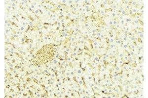 ABIN6274660 at 1/100 staining Mouse liver tissue by IHC-P.