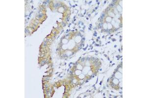 Immunohistochemistry of paraffin-embedded human colon using CRA antibody (ABIN6132087, ABIN6138999, ABIN6139001 and ABIN6217973) at dilution of 1:150 (40x lens).