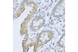 Immunohistochemistry of paraffin-embedded human colon using CRA antibody (ABIN6132087, ABIN6138999, ABIN6139001 and ABIN6217973) at dilution of 1:150 (40x lens). (EFCAB4B anticorps  (AA 1-200))