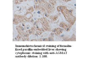 Image no. 1 for anti-Agmatine Ureohydrolase (Agmatinase) (AGMAT) antibody (ABIN1574528) (AGMAT anticorps)