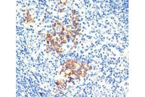Immunohistochemistry of paraffin-embedded Mouse spleen using THBS1 Polyclonal Antibody at dilution of 1:200 (40x lens). (Thrombospondin 1 anticorps)