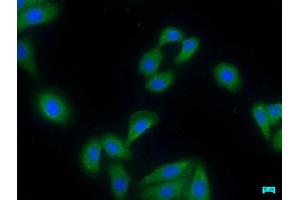 Immunofluorescence staining of HepG2 cells with ABIN7155164 at 1:50, counter-stained with DAPI. (PDE8A anticorps  (AA 596-829))