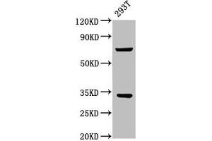 Western Blot Positive WB detected in: 293T whole cell lysate All lanes: SLC25A5 antibody at 3. (SLC25A5 anticorps  (AA 144-175))