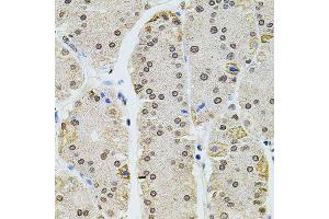 Immunohistochemistry of paraffin-embedded human stomach using HIST1H2AG antibody (ABIN6003627) at dilution of 1/100 (40x lens).