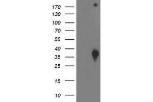 Image no. 2 for anti-DnaJ (Hsp40) Homolog, Subfamily B, Member 2 (DNAJB2) antibody (ABIN1497868) (DNAJB2 anticorps)
