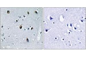 Immunohistochemistry analysis of paraffin-embedded human brain tissue, using Collagen XX alpha1 Antibody.