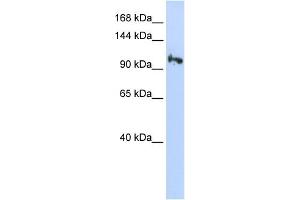 WB Suggested Anti-SMG5 Antibody Titration: 0. (SMG5 anticorps  (N-Term))