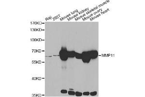 Western blot analysis of extracts of various cell lines, using MMP11 antibody. (MMP11 anticorps)