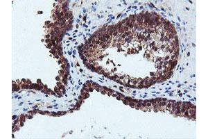 Image no. 1 for anti-Dual Specificity Phosphatase 23 (DUSP23) antibody (ABIN1497930) (DUSP23 anticorps)