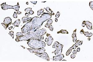 IHC analysis of PIWIL4/PIWI using anti-PIWIL4/PIWI antibody (ABIN7601940).