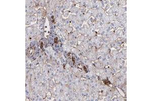 Immunohistochemical staining of human liver with ACTN4 polyclonal antibody  shows strong cytoplasmic and membranous positivity in lymphoid tissue in bile duct cells at 1:1000-1:2500 dilution. (alpha Actinin 4 anticorps)