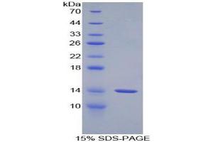 SDS-PAGE analysis of Rat GnRH Protein. (GNRH1 Protéine)