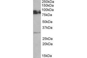 Western Blotting (WB) image for anti-Glycoprotein M6A (GPM6A) (Internal Region) antibody (ABIN2464782) (GPM6A anticorps  (Internal Region))