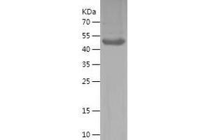 Western Blotting (WB) image for Kallikrein 8 (KLK8) (AA 33-260) protein (His-IF2DI Tag) (ABIN7123662)
