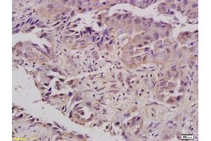 Formalin-fixed and paraffin embedded rat kidney labeled with Anti-FPR1 Polyclonal Antibody, Unconjugated (ABIN742245) at 1:200 followed by conjugation to the secondary antibody and DAB staining
