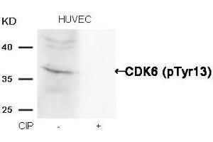 Western blot analysis of extracts from HUVEC cells, treated with calf intestinal phosphatase (CIP), using CDK6 (phospho-Tyr13) Antibody. (CDK6 anticorps  (pTyr13))