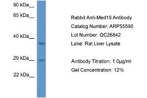Western Blotting (WB) image for anti-Mediator Complex Subunit 19 (MED19) (N-Term) antibody (ABIN2786281) (MED19 anticorps  (N-Term))