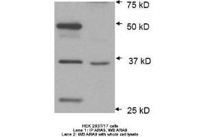 Image no. 2 for anti-Aryl Hydrocarbon Receptor Interacting Protein (AIP) antibody (ABIN363261) (AIP anticorps)