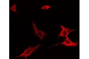 ABIN6275526 staining NIH-3T3 cells by IF/ICC. (SPINK5 anticorps  (N-Term))