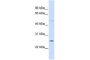 RNF170 antibody used at 1 ug/ml to detect target protein. (RNF170 anticorps  (C-Term))