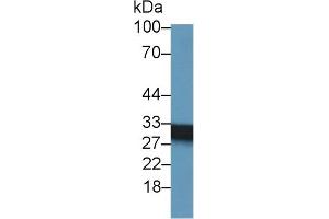 Detection of SDHB in Mouse Heart lysate using Polyclonal Antibody to Succinate Dehydrogenase Complex Subunit B (SDHB)