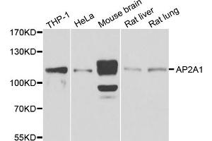 Western blot analysis of extracts of various cell lines, using AP2A1 antibody (ABIN5975765) at 1/1000 dilution. (alpha Adaptin anticorps)