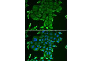 Immunofluorescence analysis of HeLa cell using CD84 antibody.