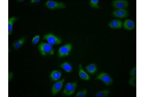 Immunofluorescence staining of A549 cells with ABIN7158892 at 1:166, counter-stained with DAPI. (MPEG1 anticorps  (AA 537-633))