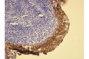 Immunohistochemistry (IHC) image for anti-Keratin 5/6 (KRT5/6) (AA 548-564), (C-Term) antibody (ABIN7598818) (Keratin 5/6 anticorps  (C-Term))