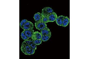 Confocal immunofluorescent analysis of ADH1C Antibody (Center) (ABIN651725 and ABIN2840376) with T47D cell followed by Alexa Fluor 488-conjugated goat anti-rabbit lgG (green).