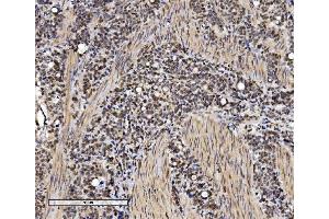 IHC analysis of VPRBP/DCAF1 using anti-VPRBP/DCAF1 antibody (ABIN7599063). (DDB1 and CUL4-Associated Factor 1 (DCAF1) (AA 1-195) anticorps)