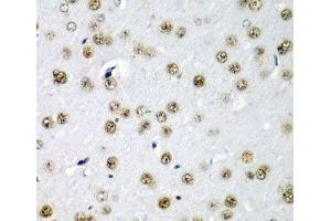 Immunohistochemistry of paraffin-embedded Rat brain using SF3B3 Polyclonal Antibody at dilution of 1:200 (40x lens). (SF3B3 anticorps)