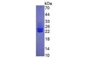 Image no. 2 for Interleukin 6 (IL6) (AA 30-212) (Active) protein (His tag) (ABIN6239792) (IL-6 Protein (AA 30-212) (His tag))