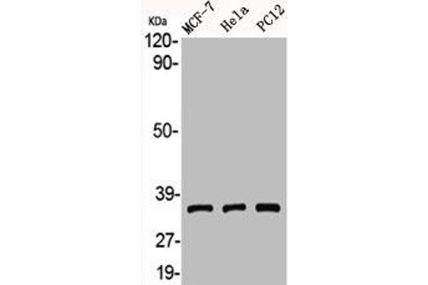 Adenosine A3 Receptor antibody  (C-Term)