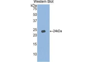 Western blot analysis of the recombinant protein. (IFNA5 anticorps  (AA 24-189))