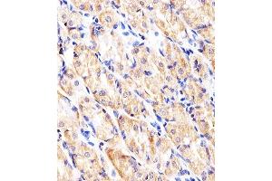 anti-Hexokinase 2 (HK2) (AA 453-483) antibody