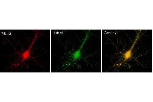 Immunofluorescence of cultured hippocampal neurons with N87/25 (red) and GABA-A-R-Gamma2 rabbit polyclonal (green).