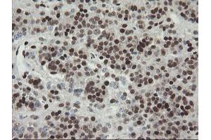 Image no. 7 for anti-Transducin-Like Enhancer of Split 1 (E(sp1) Homolog, Drosophila) (TLE1) (AA 180-460) antibody (ABIN1491049)