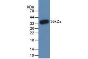Detection of Recombinant PADI3, Human using Monoclonal Antibody to Peptidyl Arginine Deiminase Type III (PADI3) (PADI3 anticorps  (AA 1-300))