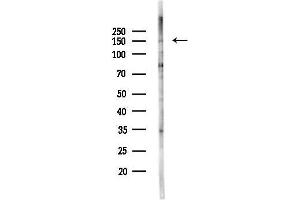 anti-Treacher Collins-Franceschetti Syndrome 1 (TCOF1) (N-Term) antibody
